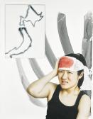 Benedict Will Diashi, Fukushima, Korean War, Bride Head, Injury Benedict Will Diashi, Fukushima, Korean War, Bride Head, Injury