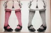 PURCELL Roy Knees PURCELL Roy Knees