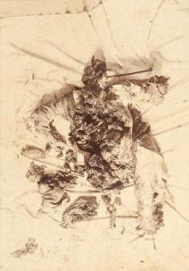 ANONYMOUS,Fragments de cadavre,1890,Damien Leclere FR 2011-05-21