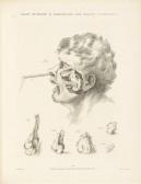 BELL John 1800-1800,The principles of surgery,Lyon & Turnbull GB 2014-01-15