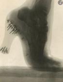 BOYER Jacques 1869-1960,Radiographies de pied (avec et sans chaussure),1920,Ader FR 2022-06-08