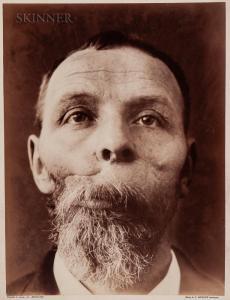 MEHEUX Félix 1838-1908,Portrait of a Surgical Patient, Hôpital St. Louis,1900,Skinner US 2020-09-24